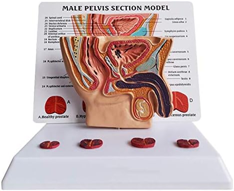 Mesane Karın Modeli-İnsan Organ Anatomik Modeli Erkek Karın Boşluğu, Mesane ve Prostat Modeli-PVC Malzeme Tıbbi Öğretim Modeli-Çalışma