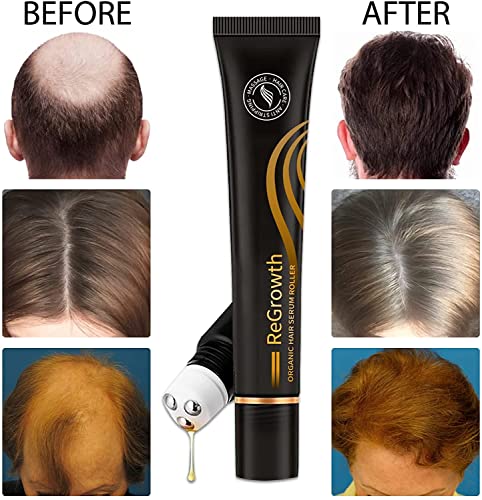 Çıkma Organik Saç Serum Rulo Seti, masaj Saç Büyüme Özü, saç Bakımı Anti Sıyırma Sıvı Erkekler ve Kadınlar için Hızlı Saç Çıkma